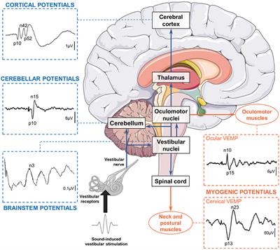 Vestibular-Evoked Cerebral Potentials